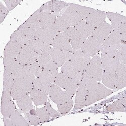 SRRM1 Polyclonal Antibody:Antibodies, Polyclonal