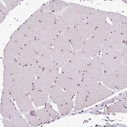Invitrogen SRRM1 Polyclonal Antibody 100 &mu;L; Unconjugated:Antibodies,