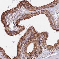 Invitrogen MOGAT1 Polyclonal Antibody 100 &mu;L; Unconjugated:Antibodies,