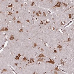 Invitrogen LRRC74B Polyclonal Antibody 100 &mu;L; Unconjugated:Antibodies,