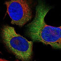 Invitrogen CCT6B Polyclonal Antibody 100 &mu;L; Unconjugated:Antibodies,