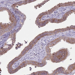 Invitrogen CCT6B Polyclonal Antibody 100 &mu;L; Unconjugated:Antibodies,