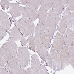 Invitrogen CCT6B Polyclonal Antibody 100 &mu;L; Unconjugated:Antibodies,