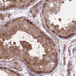 Invitrogen CCT6B Polyclonal Antibody 100 &mu;L; Unconjugated:Antibodies,
