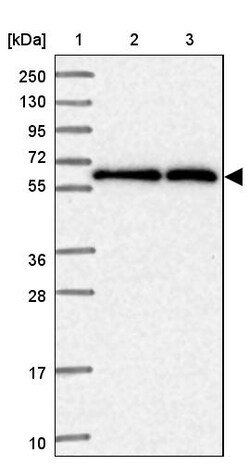 Invitrogen TCP-1 zeta Polyclonal Antibody 100 &mu;L | Buy Online | Invitrogen&trade; | Fisher Scientific