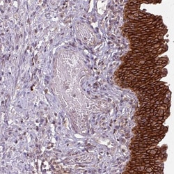 Invitrogen TUSC3 Polyclonal Antibody 100 &mu;L; Unconjugated:Antibodies,