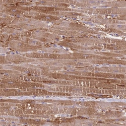 Invitrogen PRKAR1A Polyclonal Antibody 100 &mu;L; Unconjugated:Antibodies,