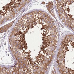 Invitrogen PRKAR1A Polyclonal Antibody 100 &mu;L; Unconjugated:Antibodies,