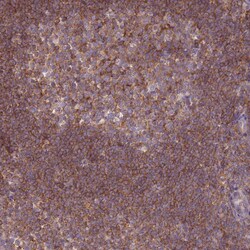 Invitrogen PRKAR1A Polyclonal Antibody 100 &mu;L; Unconjugated:Antibodies,