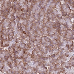 Invitrogen XKR8 Polyclonal Antibody 100 &mu;L | Buy Online | Invitrogen&trade; | Fisher Scientific