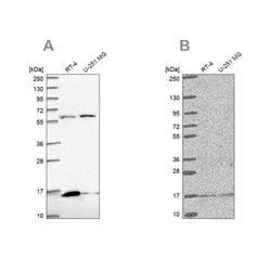 Invitrogen MRPS16 Polyclonal Antibody 100 &mu;L; Unconjugated:Antibodies,