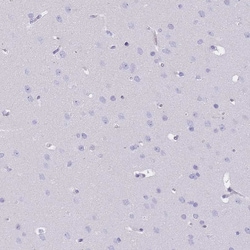 Invitrogen GOLGA6B Polyclonal Antibody 100 &mu;L; Unconjugated:Antibodies,