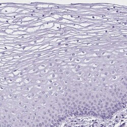 Invitrogen GOLGA6B Polyclonal Antibody 100 &mu;L; Unconjugated:Antibodies,
