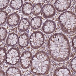 Invitrogen CXorf38 Polyclonal Antibody 100 &mu;L; Unconjugated:Antibodies,