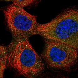 Invitrogen CXorf38 Polyclonal Antibody 100 &mu;L; Unconjugated:Antibodies,