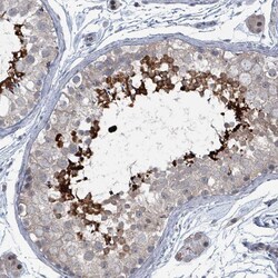 Invitrogen BIVM Polyclonal Antibody 100 &mu;L; Unconjugated:Antibodies,