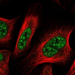 Invitrogen GLYR1 Polyclonal Antibody 100 &mu;L; Unconjugated:Antibodies,