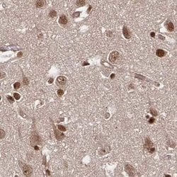 Invitrogen GLYR1 Polyclonal Antibody 100 &mu;L; Unconjugated:Antibodies,
