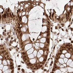 Invitrogen GLYR1 Polyclonal Antibody 100 &mu;L; Unconjugated:Antibodies,