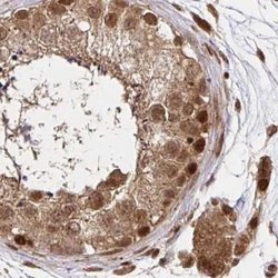 Invitrogen GLYR1 Polyclonal Antibody 100 &mu;L; Unconjugated:Antibodies,