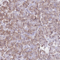 Invitrogen VSIG2 Polyclonal Antibody 100 &mu;L; Unconjugated:Antibodies,
