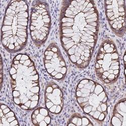 Invitrogen VSIG2 Polyclonal Antibody 100 &mu;L; Unconjugated:Antibodies,