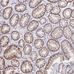 Invitrogen VSIG2 Polyclonal Antibody 100 &mu;L; Unconjugated:Antibodies,