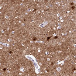Invitrogen KCTD16 Polyclonal Antibody 100 &mu;L; Unconjugated:Antibodies,