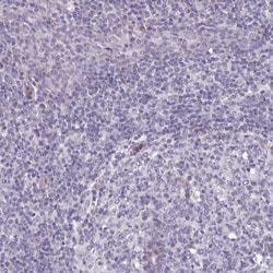 Invitrogen KCTD16 Polyclonal Antibody 100 &mu;L; Unconjugated:Antibodies,