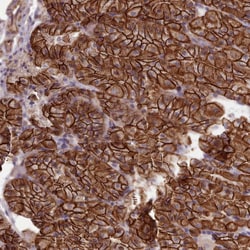 Invitrogen MRPL46 Polyclonal Antibody 100 &mu;L; Unconjugated:Antibodies,