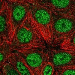 Invitrogen WDR18 Polyclonal Antibody 100 &mu;L; Unconjugated:Antibodies,