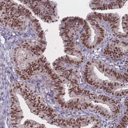 Invitrogen WDR18 Polyclonal Antibody 100 &mu;L; Unconjugated:Antibodies,
