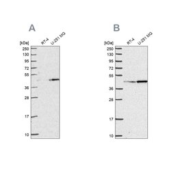 Invitrogen WDR18 Polyclonal Antibody 100 &mu;L; Unconjugated:Antibodies,