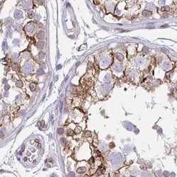 Nesprin 2 Polyclonal Antibody, Invitrogen 100 &mu;L; Unconjugated:Antibodies,