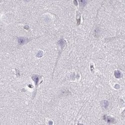 Nesprin 2 Polyclonal Antibody, Invitrogen 100 &mu;L; Unconjugated:Antibodies,