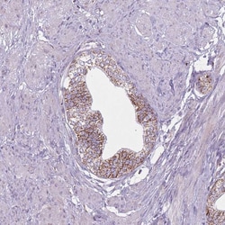 Invitrogen DCHS1 Polyclonal Antibody 100 &mu;L; Unconjugated:Antibodies,