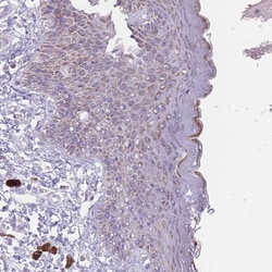 Invitrogen DCHS1 Polyclonal Antibody 100 &mu;L; Unconjugated:Antibodies,