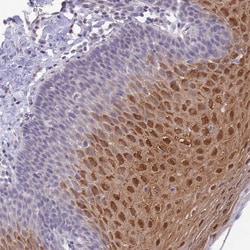 Invitrogen C19orf25 Polyclonal Antibody 100 &mu;L; Unconjugated:Antibodies,