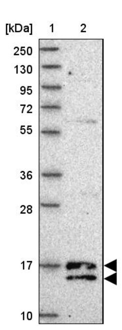 Invitrogen C19orf25 Polyclonal Antibody 100 &mu;L; Unconjugated:Antibodies,