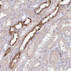 Invitrogen NT5C1A Polyclonal Antibody 100 &mu;L | Buy Online | Invitrogen&trade; | Fisher Scientific