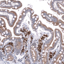Invitrogen TMED5 Polyclonal Antibody 100 &mu;L; Unconjugated:Antibodies,
