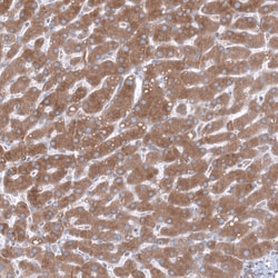Invitrogen TMED5 Polyclonal Antibody 100 &mu;L; Unconjugated:Antibodies,