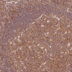 Invitrogen PDAP1 Polyclonal Antibody 100 &mu;L; Unconjugated:Antibodies,