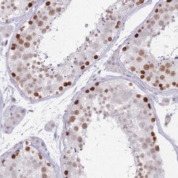 Invitrogen BDP Polyclonal Antibody 100 &mu;L; Unconjugated:Antibodies,