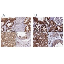 Invitrogen UQCRFS1 Polyclonal Antibody 100 &mu;L; Unconjugated:Antibodies,
