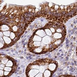 Invitrogen UQCRFS1 Polyclonal Antibody 100 &mu;L; Unconjugated:Antibodies,