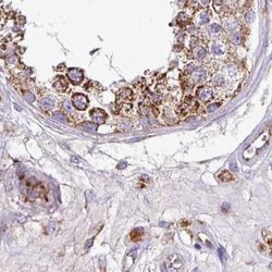 Invitrogen UQCRFS1 Polyclonal Antibody 100 &mu;L; Unconjugated:Antibodies,