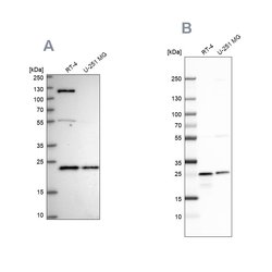 Invitrogen UQCRFS1 Polyclonal Antibody 100 &mu;L; Unconjugated:Antibodies,