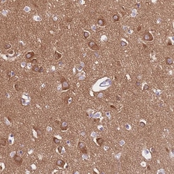 Invitrogen PPFIA3 Polyclonal Antibody 100 &mu;L; Unconjugated:Antibodies,