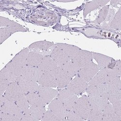 Invitrogen PPFIA3 Polyclonal Antibody 100 &mu;L; Unconjugated:Antibodies,